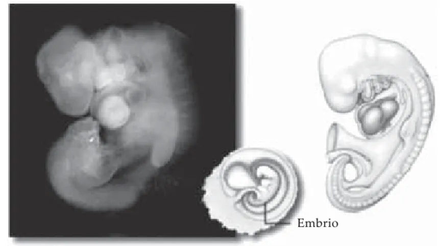 Gambar 2.6 Embrio umur 4 minggu.