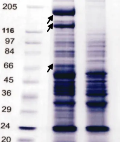 Gambar 1. Profil protein total Nephotettix virescens  penular aktif dan bukan penular aktif