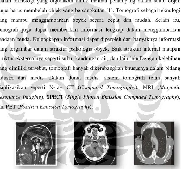 Gambar 2. 3 Citra tomografi dalam dunia medis 