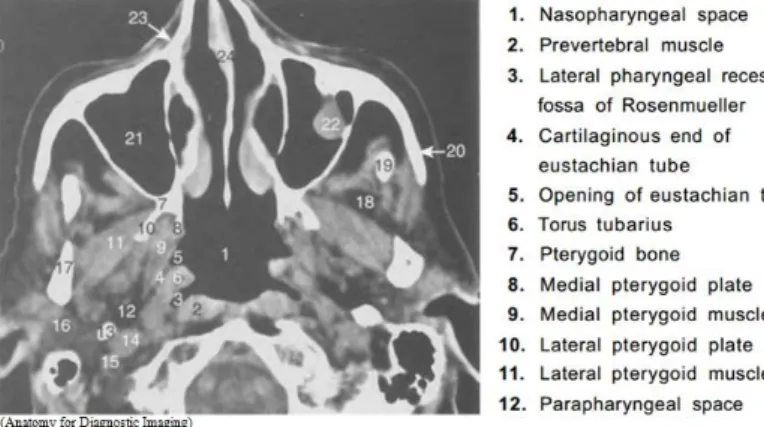 Gambar 3.Diagram menunjukkan jaringan lunak pre oksipital di midline setinggi  pertengahan  nasofaring.(e  =  eustachian  orifice,  f  =  fossa  of  Rosenmuller,  pbf  =  faringobasilar fascia, RPS  = Retropharyngeal space, PVS  = provertebral space,  POS 