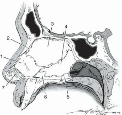 Gambar 2.3. Anatomi Hidung, Septum nasi (1), kartilago kuadrangularis  (2), os nasal (3), os vomer (4), krista nasalis os palatina (5), krista nasalis 