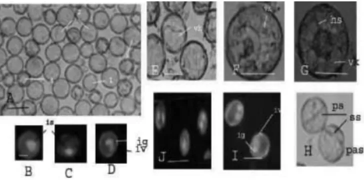 Gambar 1.Stadium perkembangan mikrospora pada berbagai ukuran  kuncup.