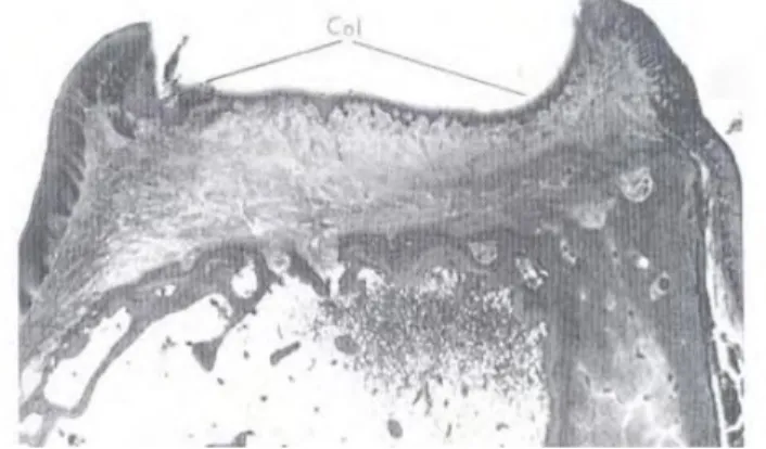 Gambar 1.3. Potongan faciolingual gingiva inerdental