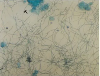 Gambar 1. Pengamatan di bawah mikroskop apusan vagina tikus yang telah mela- mela-kukan kopulasi