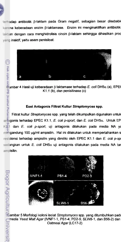 Gambar 4 Hasil uji keberadaan p laktamase terhadap E. coli DH5a (a). EPEC 