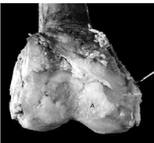 Gambar 2.2  Gambaran Radiologik Osteoartritis Lutut 9