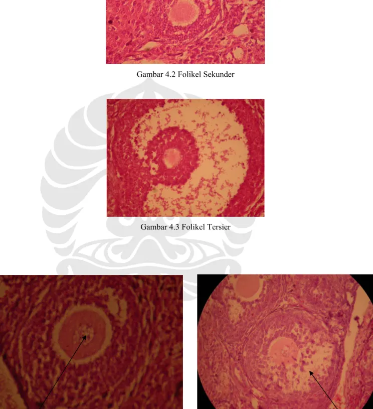 Gambar 4.3 Folikel Tersier 