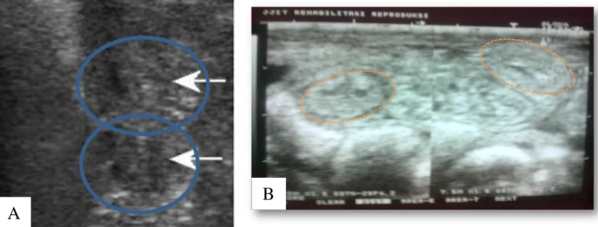 Gambar  1.  Gambaran  uterus  telah  mengalami  involusi  (A)  (dzunczyk  et  al.  2004)  dan  Gambaran  uterus telah mengalami involusi, hasil penelitian (B)