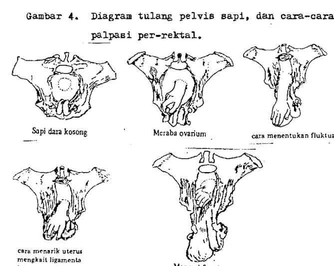Gambar  4.  Diagram  tulang  pelvis  sapi,  dan  cara-cara  palpasi  per-rektal. 