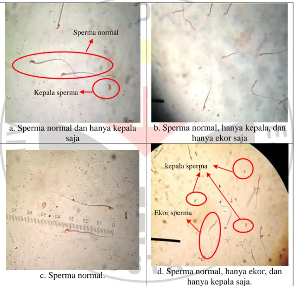 Gambar 4.3 Sperma Normal dan Sperma Abnormal (Sekunder) pada Mencit  Pembesaran 400X (Sumber: dokumentasi pribadi) 