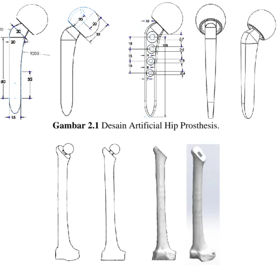 Gambar 2.1 Desain Artificial Hip Prosthesis.  