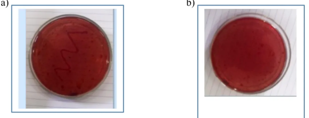 Gambar hasil pengamatan uji hidrolisis lemak pada a) koloni bakteri A, dan b) koloni bakteri B
