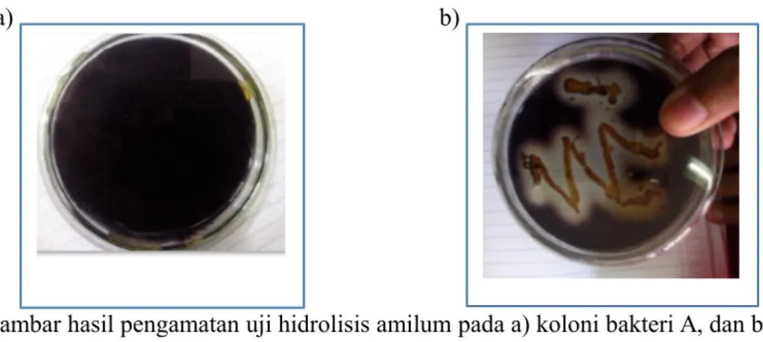 Gambar hasil pengamatan uji hidrolisis amilum pada a) koloni bakteri A, dan b) koloni bakteri B