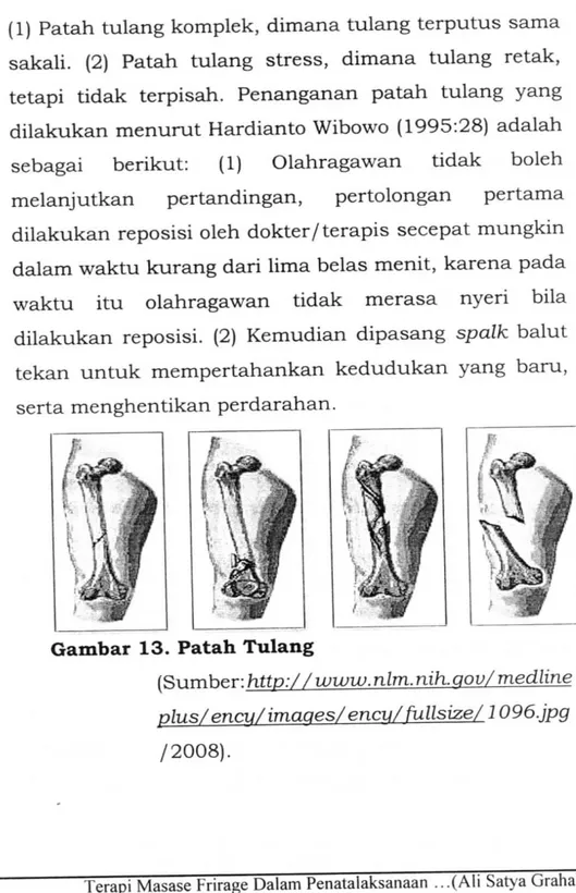 Gambar 13. Patah Tulang 