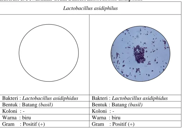 Ilustrasi 1. Pewarnaan Gram Bakteri Lactobacillus asidiphilus  Lactobacillus asidiphilus 