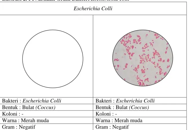 Ilustrasi 2. Pewarnaan Gram Bakteri Escherichia colli  Escherichia Colli 