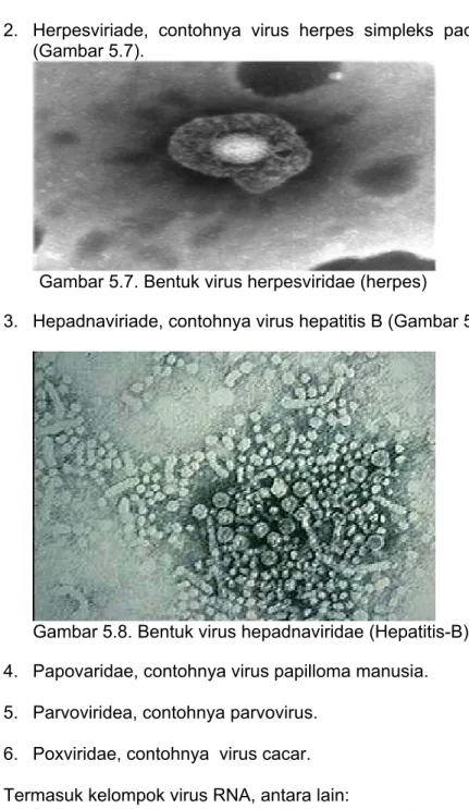 Gambar 5.8. Bentuk virus hepadnaviridae (Hepatitis-B). 
