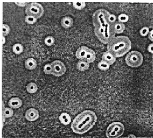Gambar 3.7 Struktur kapsul pada sel bakteri dilihat dengan mikroskop cahaya   (Sumber: Todar,K.,2001) 
