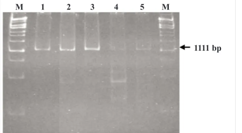 Gambar 1. Visualisasi fragmen DNA hasil amplifikasi PCR menggunakan primer S-CRF &amp; S-CRR pada PAGE 6%