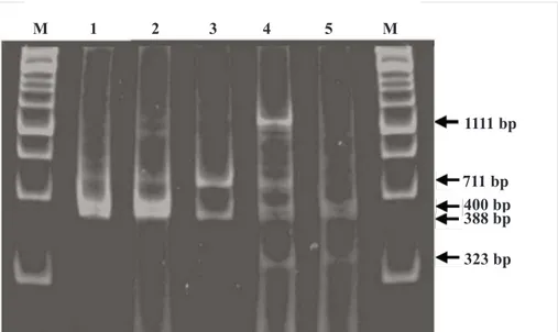 Gambar 3. Visualisasi pita DNA BBTV hasil pemotongan menggunakan enzim Dra I pada PAGE 6% M: