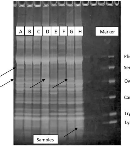 Gambar 3. Pola band Gel Electrophoresis SDS Page dari masing-masing kerang contoh dan standar  protein yang digunakan dalam penelitian ini