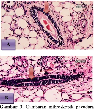 Gambar 3.  Gambaran  mikroskopik  payudara  mencit  KP-II. Keterangan: A) pembesaran 100  kali; B) pembesaran 400 kali