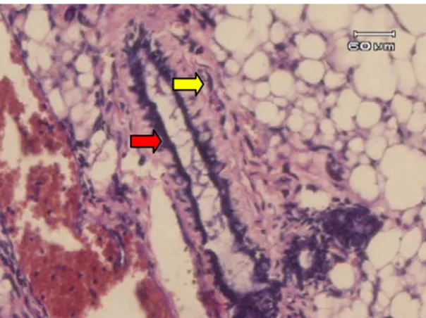 Gambar  3.  Gambaran mikroskopik payudara  mencit  kelompok C (perlakuan 2) diinduski  benzo(a)pyrene  dan diberikan ekstrak lengkuas