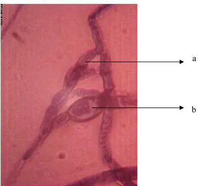Gambar 1. Bentuk Klamidospora pada jamur Pythium spp.