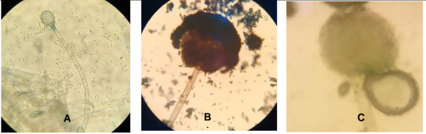 Gambar 1. Mikroskopis A) Rhizopus sp., B) Mucor sp. dan C) Aspergillus sp.  