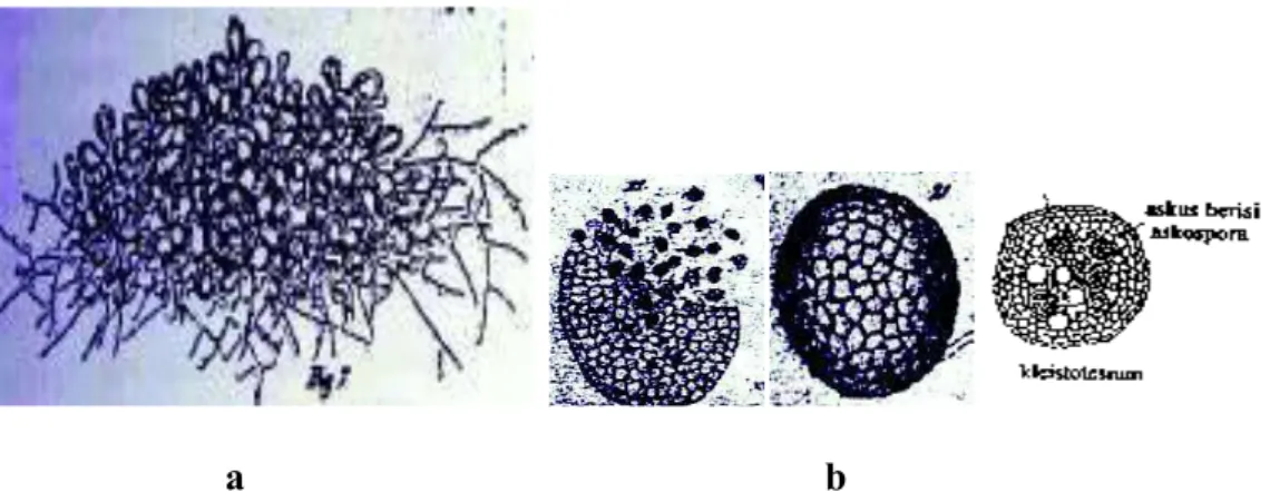 Gambar 2.3 a) Kleistotesium muda yang tertutup oleh perkembangan  Hulle  cells  b) Perkembangan kleistotesium (Raper and Fennell, 1965) 