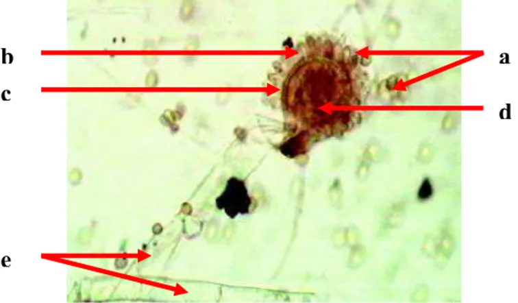 Gambar 2.7  Struktur morfologi Aspergillus flavus x400 a) Konidium b)Fialid  c) Metula d) Vesikula e) Konidiofor 