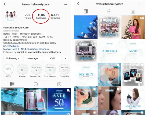 Gambar 4.1 Akun Instagram klinik Favourite Beauty Care  (@favouritebeautycare) dengan jumlah 11,9K followers 