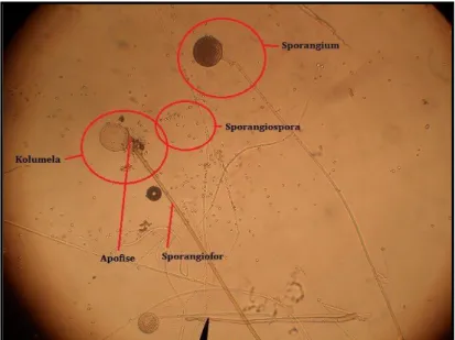 Gambar 6. Mikroskopik kapang Rhizopus oryzae  [Sumber : Dokumentasi pribadi] 