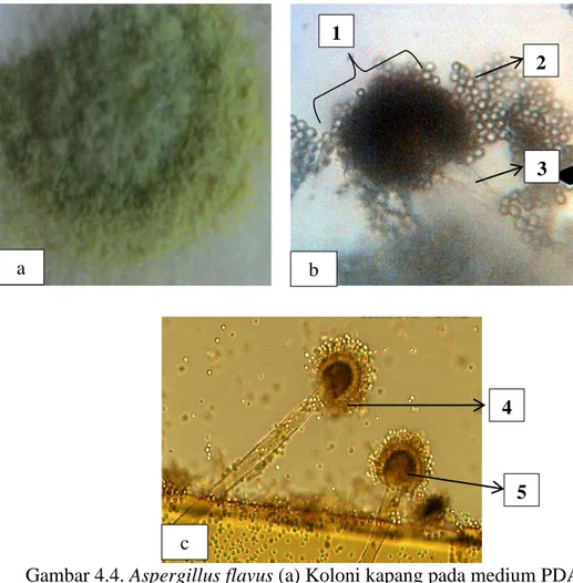 Gambar 4.4. Aspergillus flavus (a) Koloni kapang pada medium PDA dan           (b) Ciri Mikroskopis Kapang (10x40) 50 , (c) Foto Hasil             referensi 51 , 1: Kepala Konidia, 2: Konidia, 3: Konidiofor,             4: Fialid, 5: Vesikel