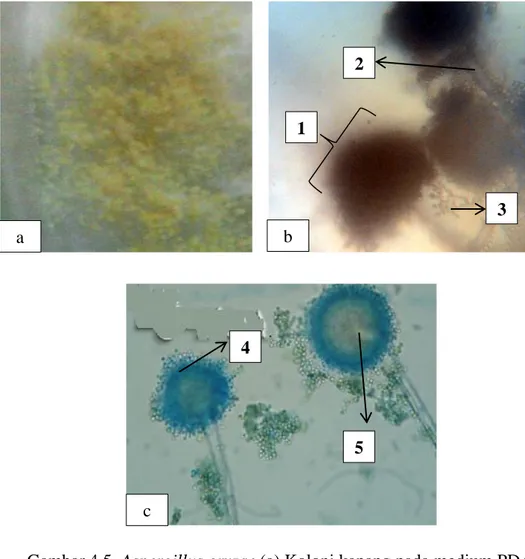 Gambar 4.5. Aspergillus oryzae (a) Koloni kapang pada medium PDA  dan (b) Ciri Mikroskopis Kapang (10x40) 53 , (c) Foto Hasil   Referensi 54 , 1:Kepala Konidia, 2: Konidia, 3: Konidiofor,   4: Fialid, 5:Vesikel