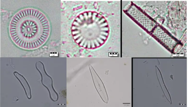 Gambar  2.  Diatom  sebagai  bioindikator  kualitas  perairan  (dari  kiri  atas:  Cyclotella  stelligera,  Cyclotella  meneghiniana,  Aulacoseira  granulata);  dari  kiri  bawah:  Eunotia  &amp; 