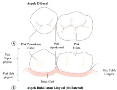 Gambar 2.2 Diagram ilustrasi perbedaan permukaan pada gigi, dan terminology  untuk mendeskripsikan lokasi sampel plak dental (Marsh &amp; Martin, 2010)