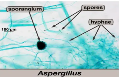 Gambar  2.3 Spora dan hifa  jamur Aspergillus (Sumber : Misd ar dkk, 2013)