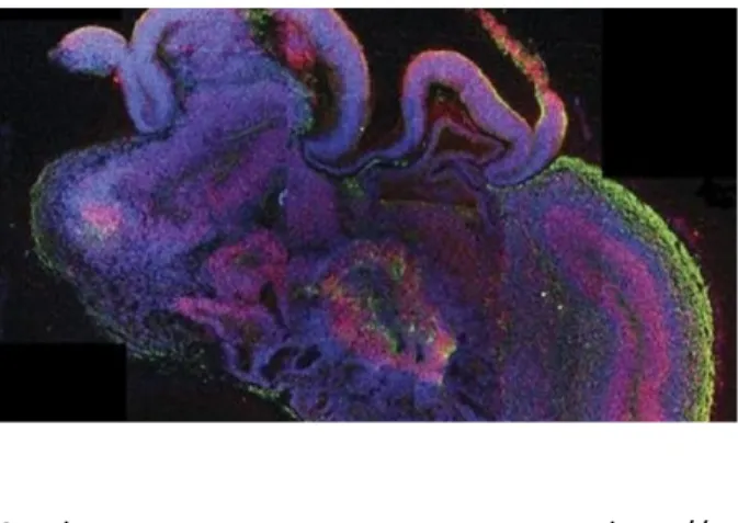 Gambar	
  1	
  Penampang	
  lintang	
  organoid	
  yang	
   menunjukkan	
  perkembangan	
  dari	
  beragam	
   bagian	
  otak.	
   	
   	
   	
   	
   	
   	
   Sumber	
   :	
   http://	
   http://sains.kompas.com/read/2013	
   Ilmuwan	
   mengumumkan	
  