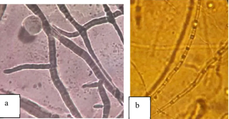 Gambar 2. Morfologi mikroskopis jamur O. Theobromae:  