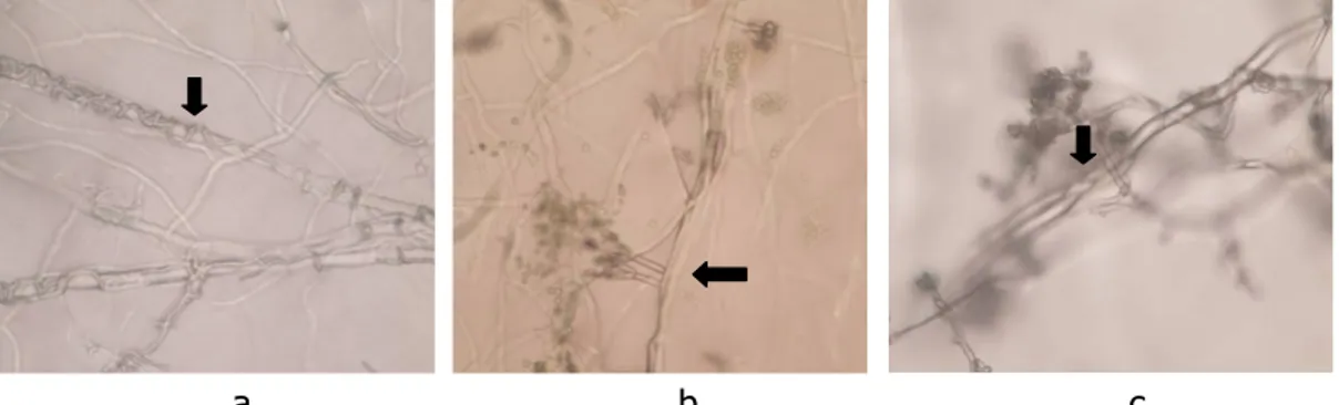 Gambar 6.18 Gejala layu pada tanaman kacang hijau fase kecambah (a), bagian  pangkal batang berwarna coklat yang dipotong untuk diisolasi  patogennya (b) 