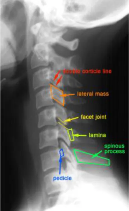 Gambar 2.27 Bone pada C-spine proyeksi lateral 15