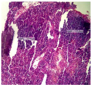 Gambar 2B. Histopatologi organ limpa  mencit diinfeksi M.Tb kelompok P1 dengan  teh kombinasi dan diterminasi setelah 24 jam  pasca infeksi