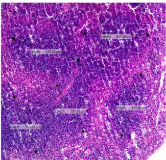 Gambar 2F. Histopatologi organ limpa  mencit diinfeksi M.Tb kelompok P3 dengan  teh kombinasi dan diterminasi setelah 7 hari  pasca infeksi