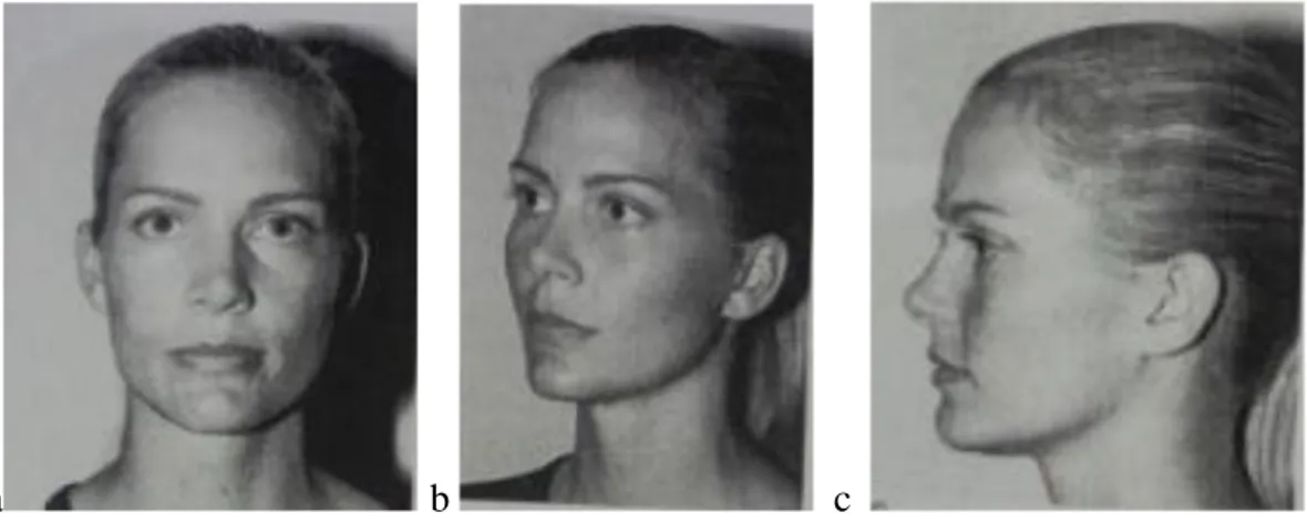 Gambar 2.1 Posisi foto wajah standar. a. Posisi AP, b. posisi oblik, c. posisi lateral 