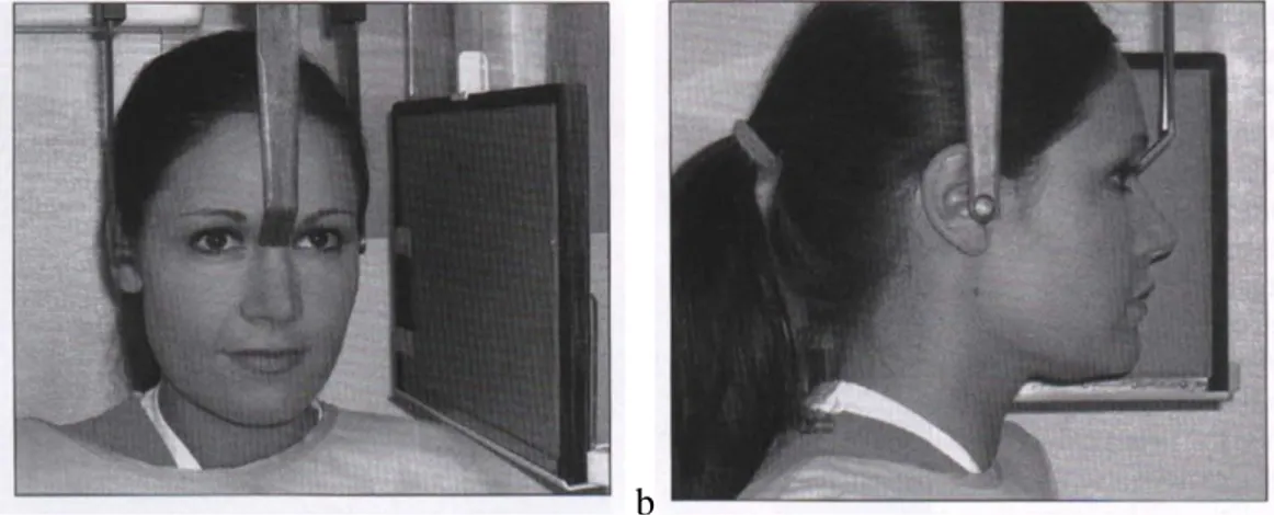 Gambar 2.3 Posisi pasien saat dilakukan sefalometri lateral. a. tampak depan, b. tampak samping