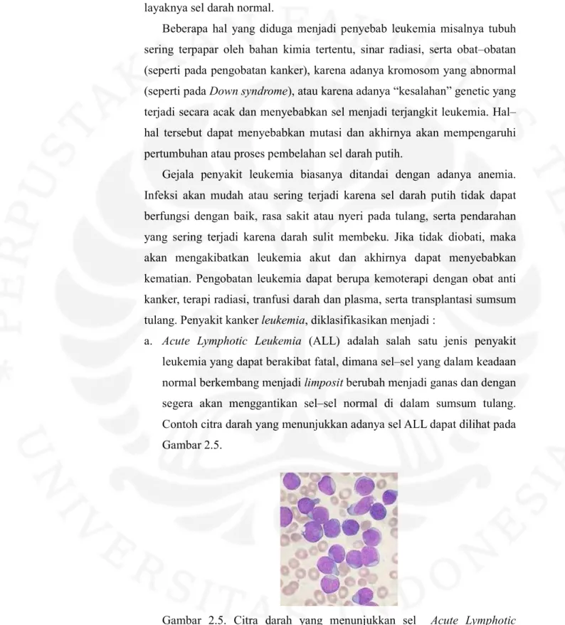 Gambar  2.5.  Citra  darah  yang  menunjukkan  sel    Acute  Lymphotic  Leukemia (ALL) [9] 