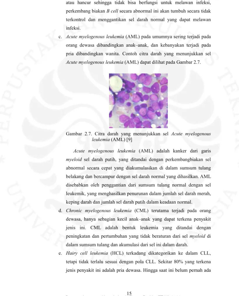 Gambar  2.7.  Citra  darah  yang  menunjukkan  sel  Acute  myelogenous  leukemia (AML) [9] 