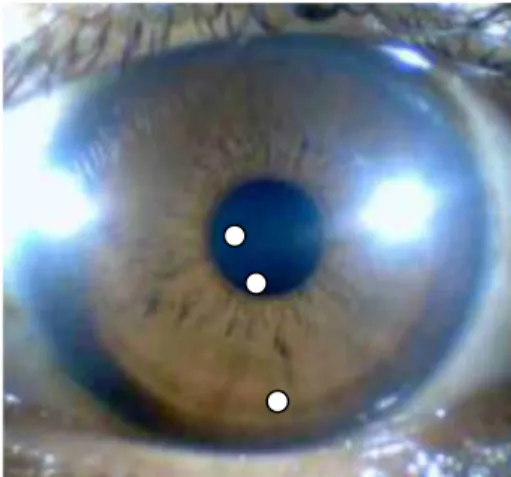 Gambar 3.1  Contoh  penentuan  tiga  buah  titik  untuk  jari- jari-jari mata, tepi luar pupil, dan tepi luar iris
