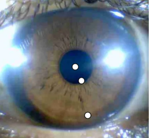 Gambar 3.1 Contoh penentuan tiga buah titik untuk  jari-jari mata, tepi luar pupil, dan tepi luar iris